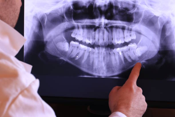 Best Broken or Chipped Tooth Repair in Empire, CA